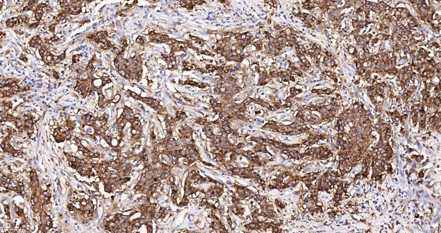 组织相容性复合体2重组兔单抗