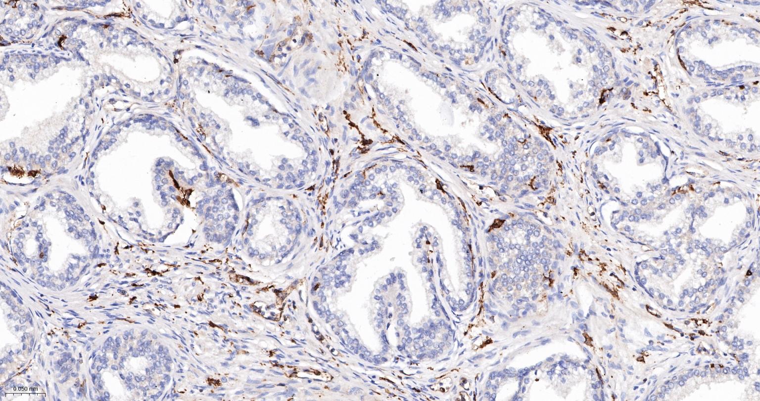 组织相容性复合体2重组兔单抗