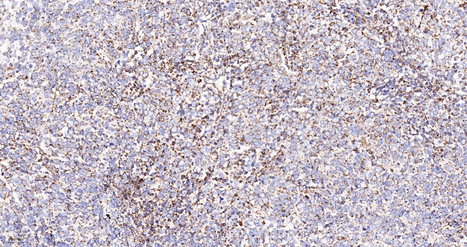 丙酮酸脱氢酶E1β亚单位重组兔单抗