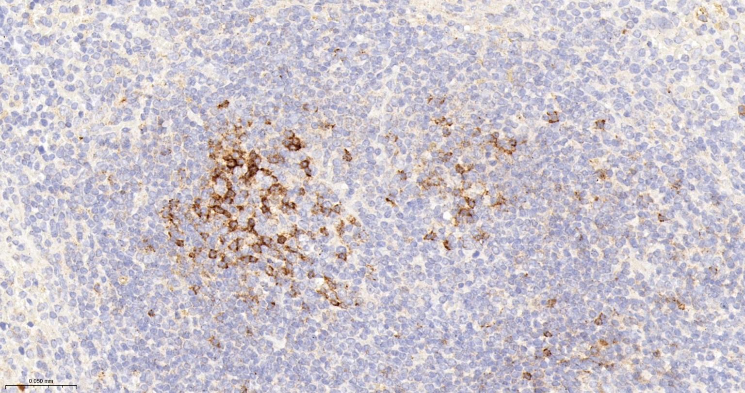 程序性死亡1(CD279)重组兔单抗