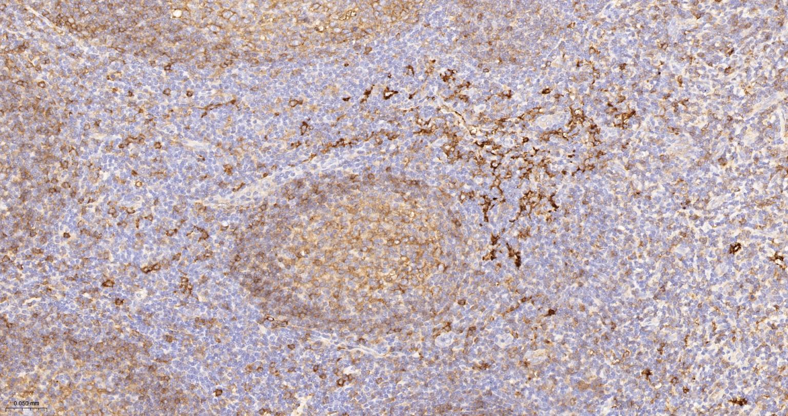 组织相容性复合体2重组兔单抗