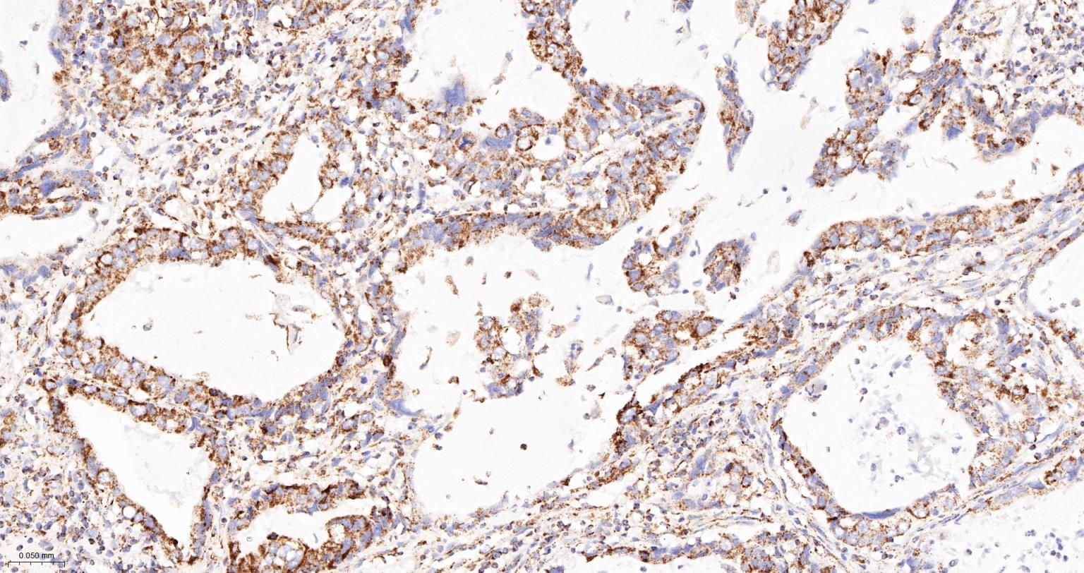 丙酮酸脱氢酶E1β亚单位重组兔单抗