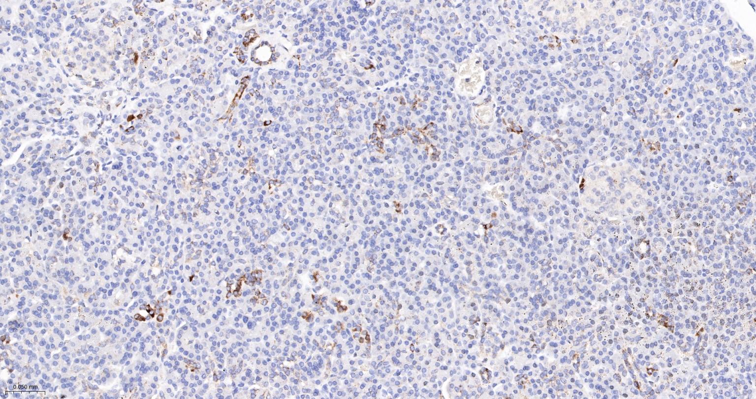 丙酮酸脱氢酶E1β亚单位重组兔单抗