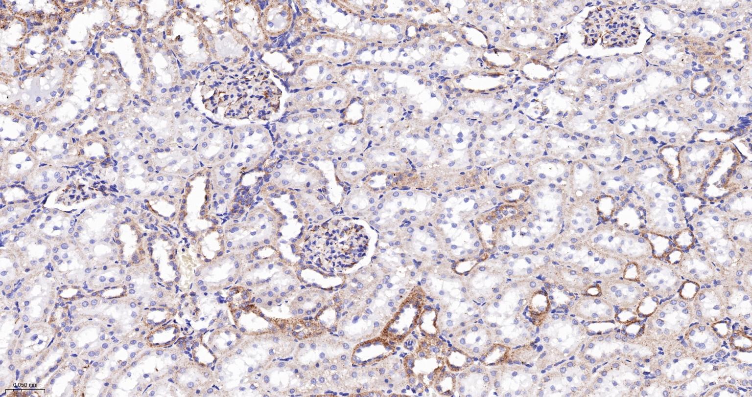 丙酮酸脱氢酶E1β亚单位重组兔单抗