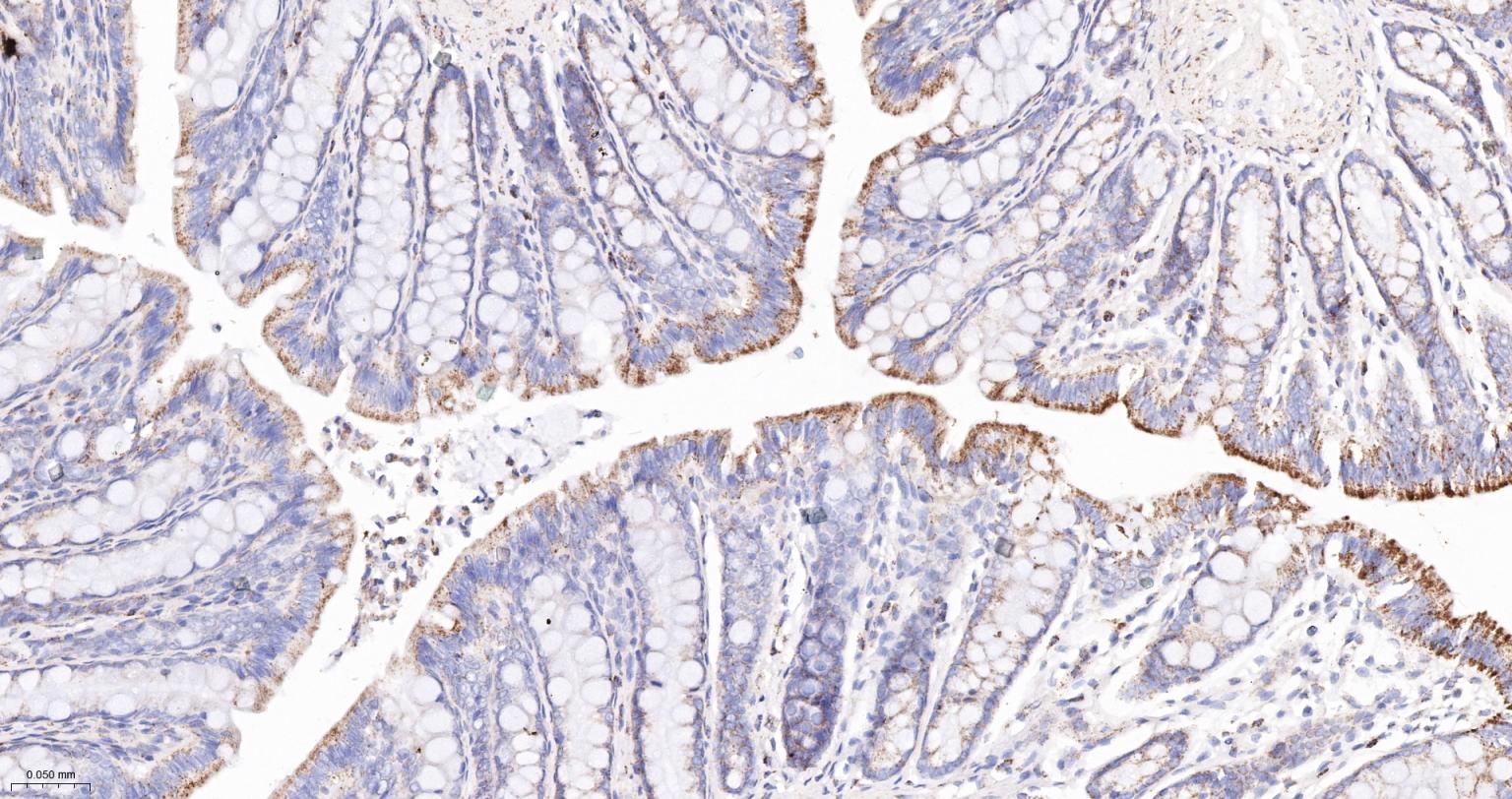 丙酮酸脱氢酶E1β亚单位重组兔单抗