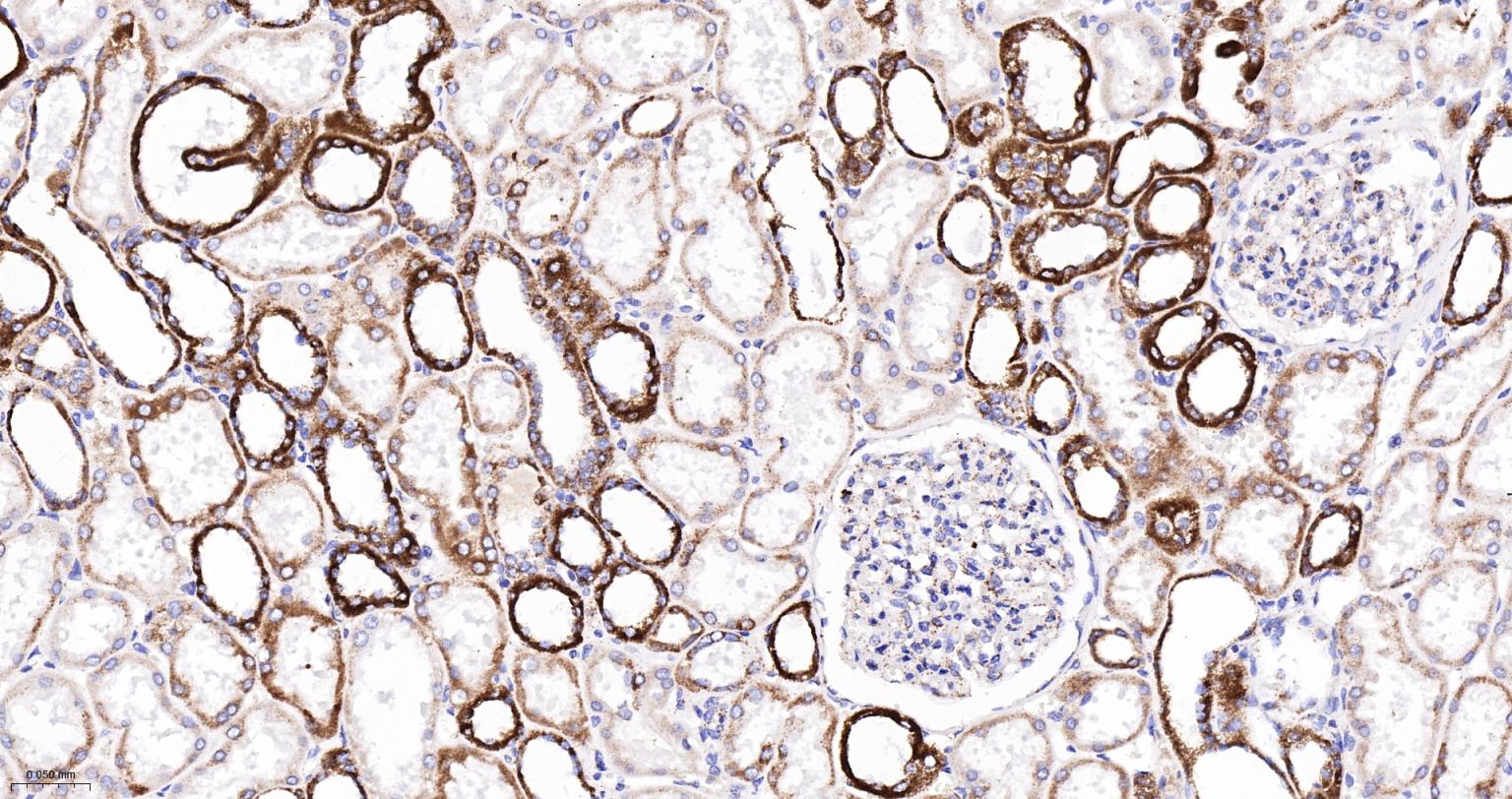 丙酮酸脱氢酶E1β亚单位重组兔单抗