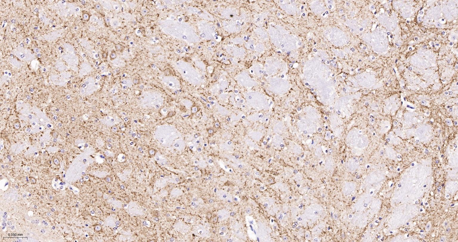 囊泡相关膜蛋白1重组兔单抗-bsm-61962R