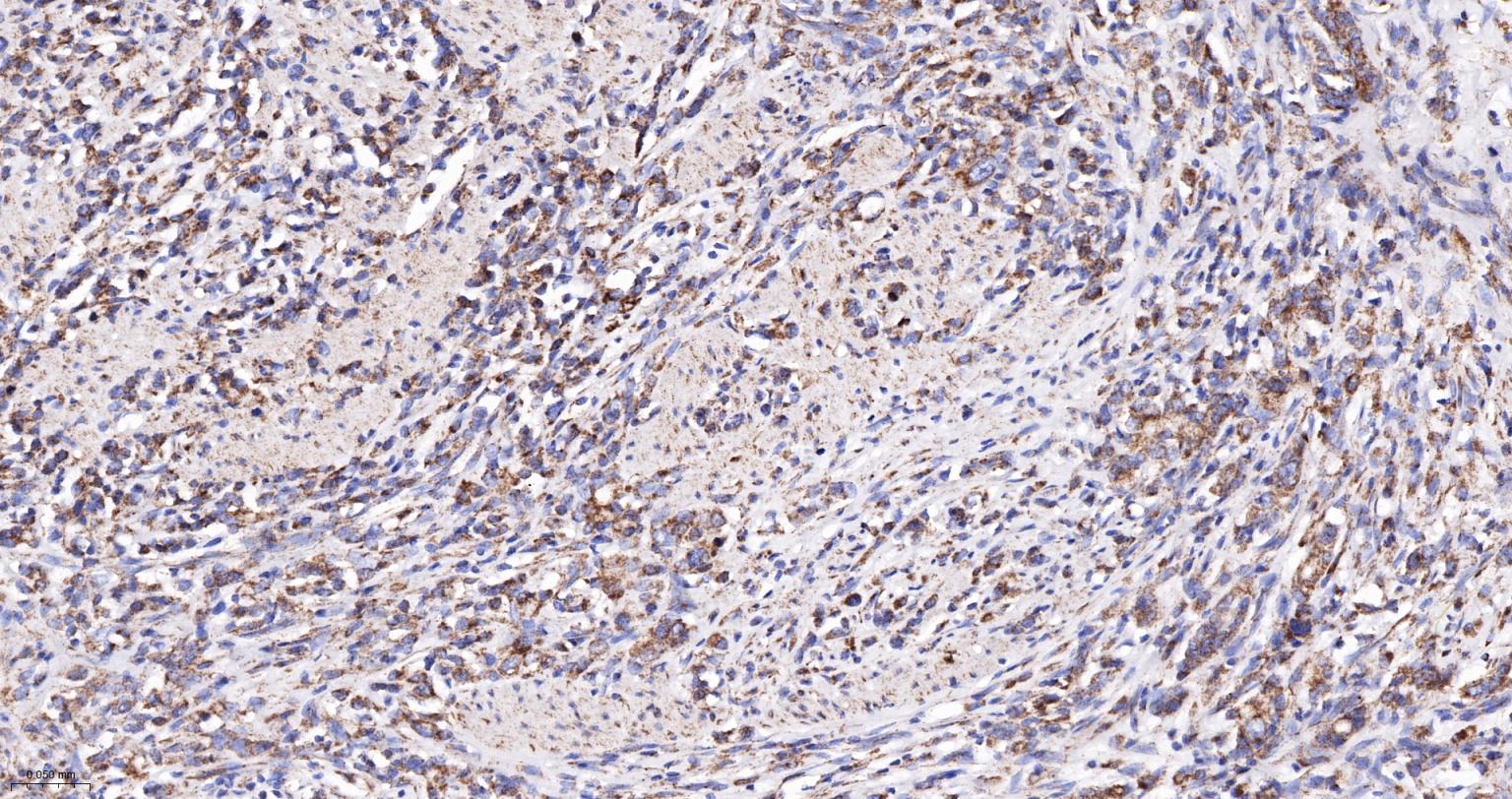 丙酮酸脱氢酶E1β亚单位重组兔单抗