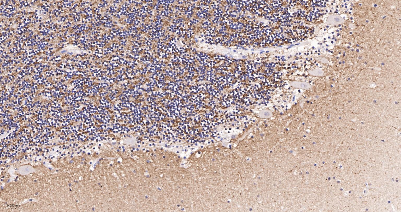 囊泡相关膜蛋白1重组兔单抗-bsm-61962R