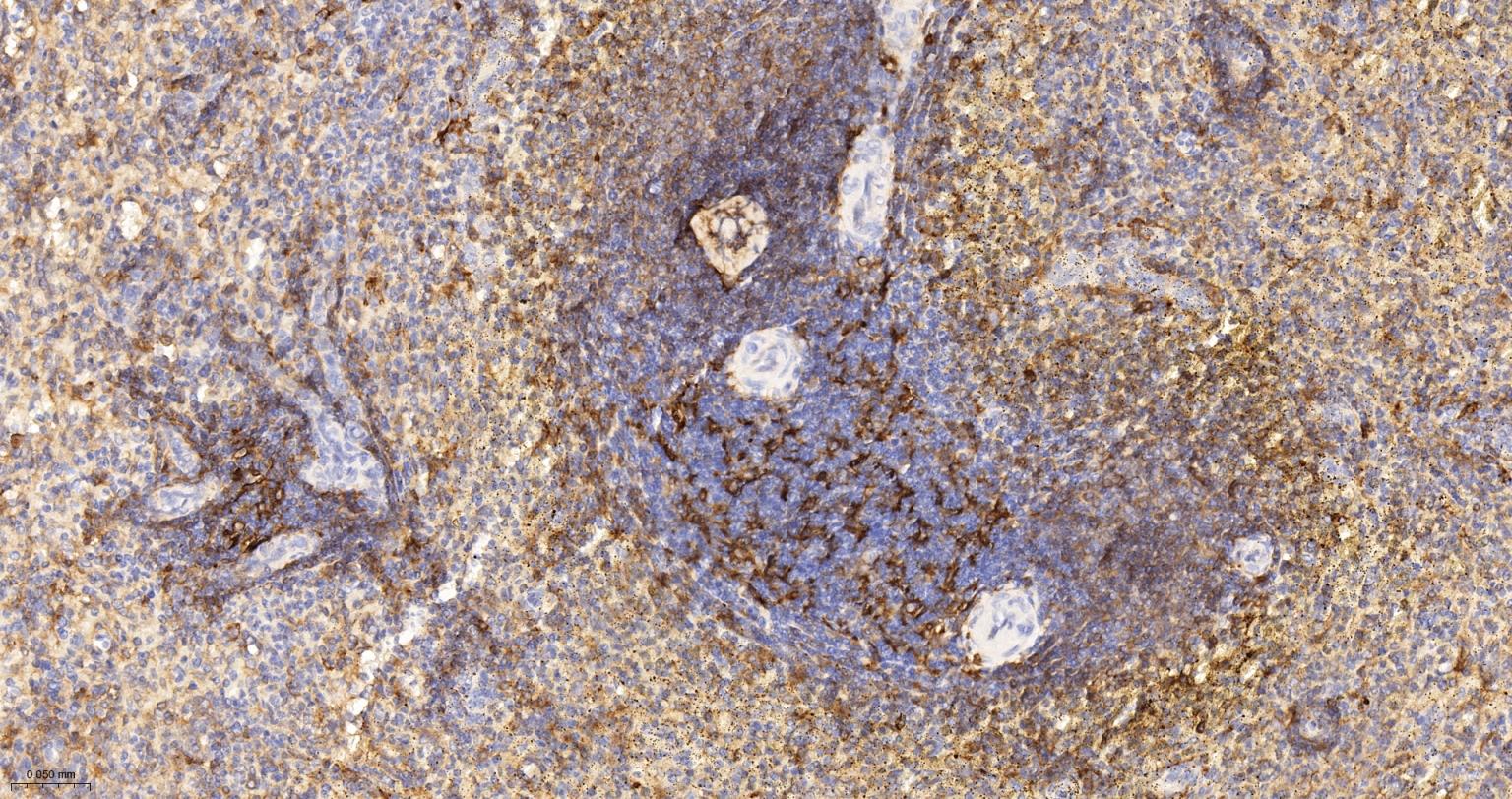 组织相容性复合体2重组兔单抗