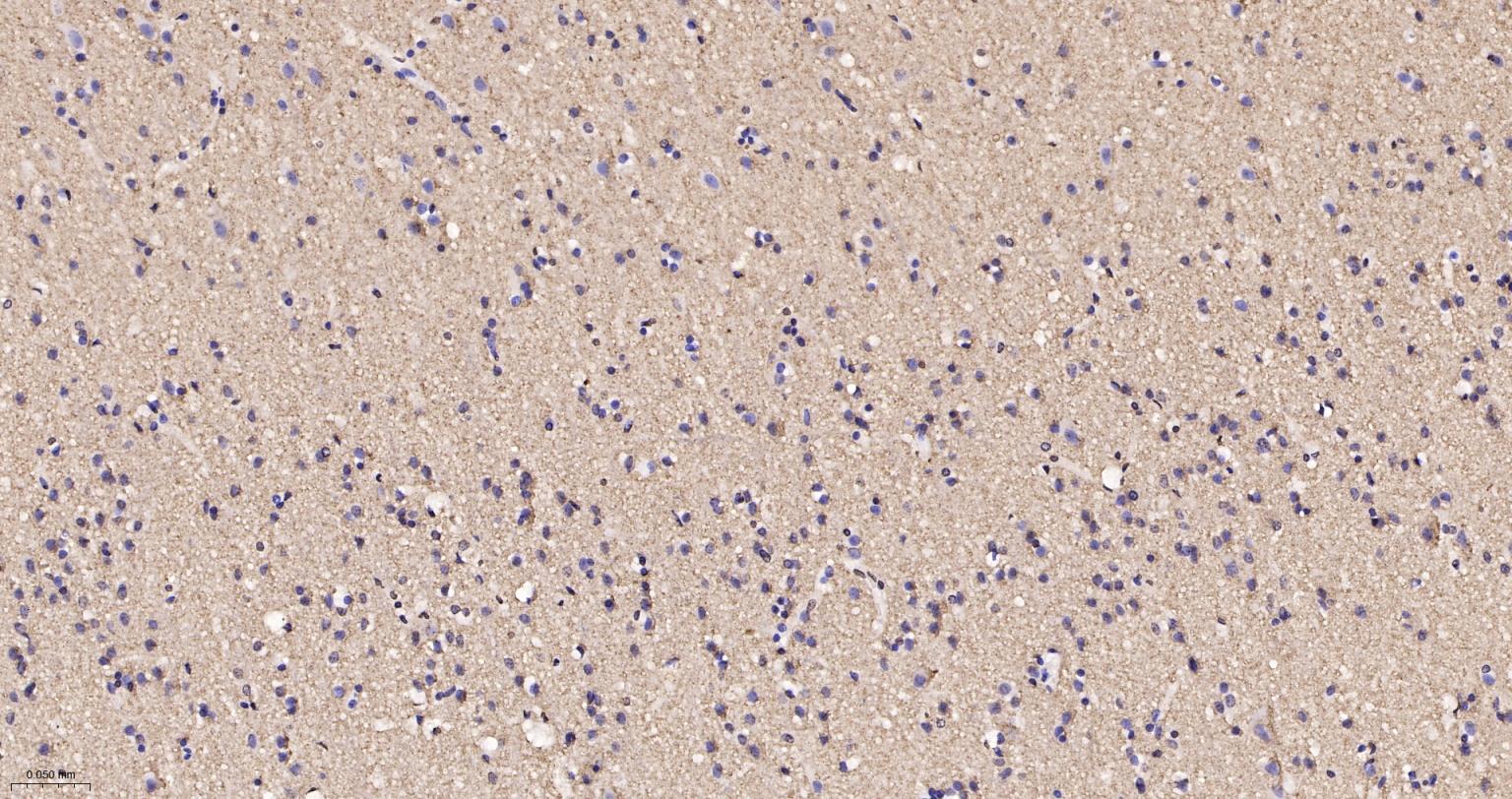 囊泡相关膜蛋白1重组兔单抗-bsm-61962R