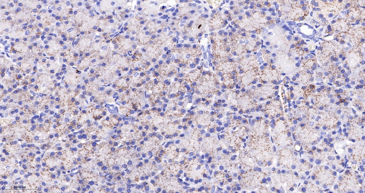 丙酮酸脱氢酶E1β亚单位重组兔单抗