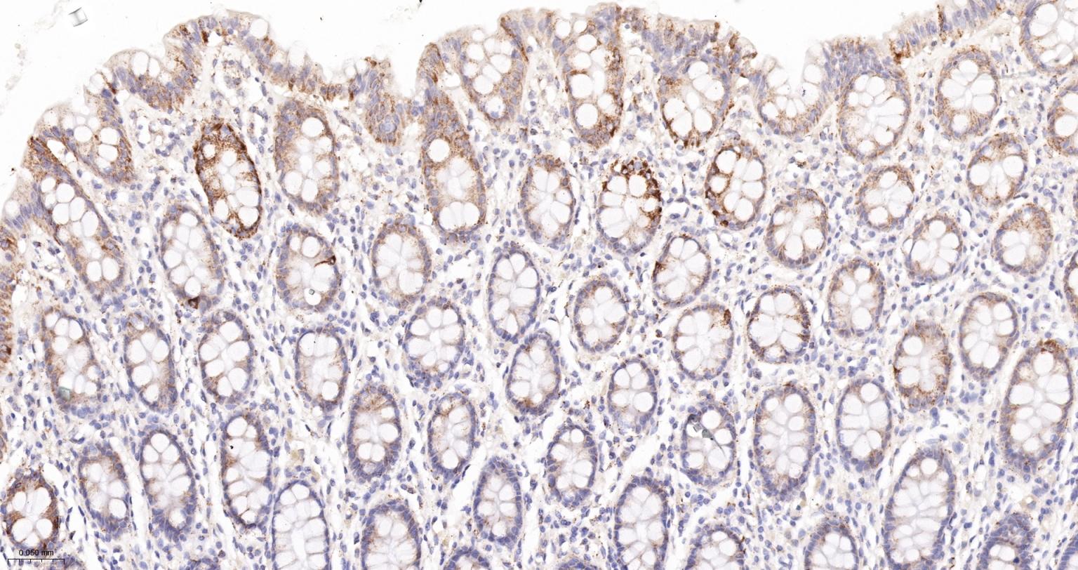 丙酮酸脱氢酶E1β亚单位重组兔单抗