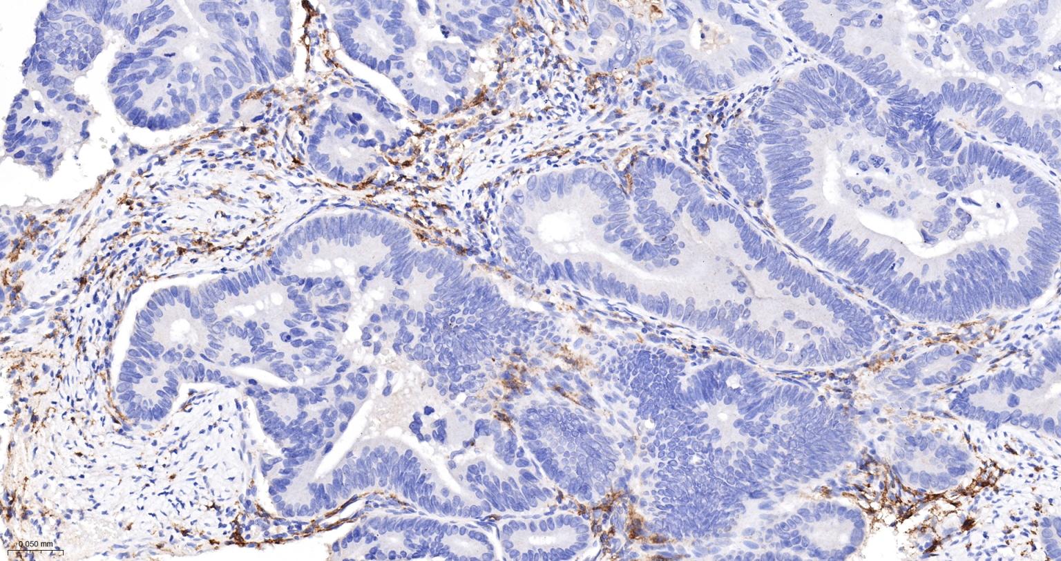 组织相容性复合体2重组兔单抗