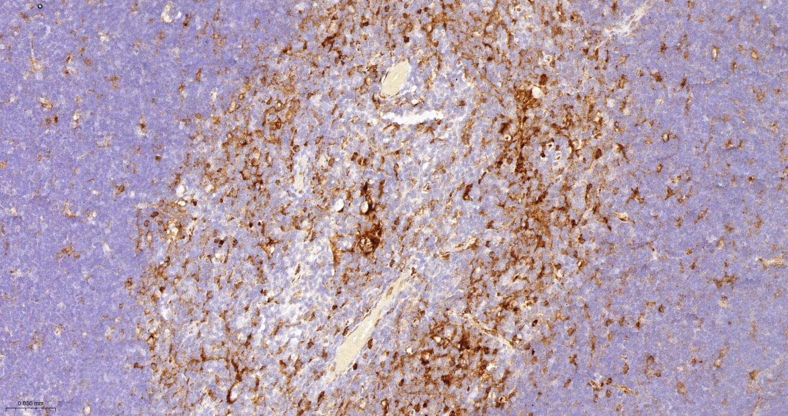 FC段γ受体3/免疫球蛋白G Fc段受体III重组兔单抗