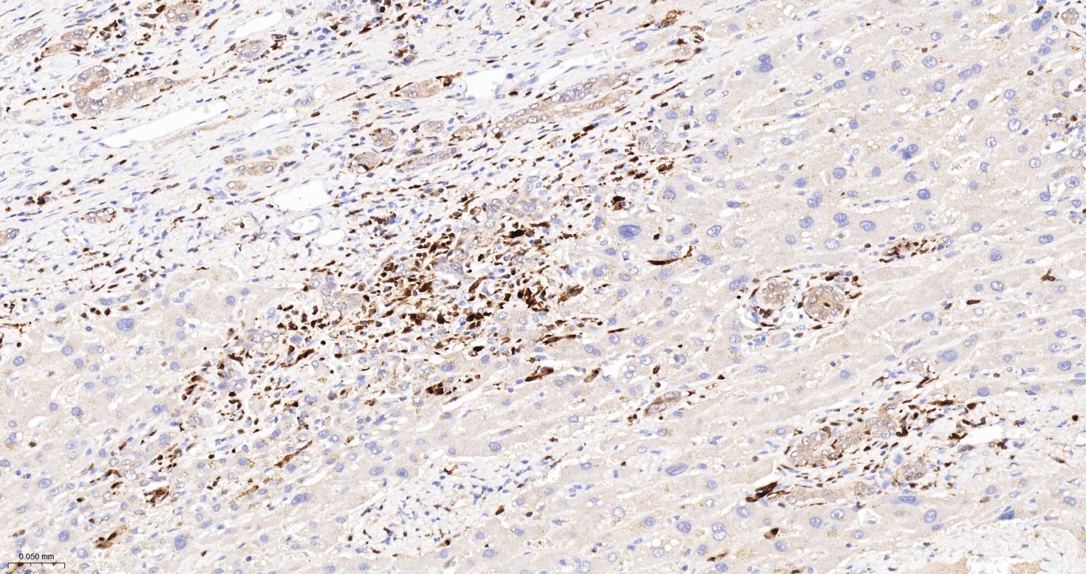 FC段γ受体3/免疫球蛋白G Fc段受体III重组兔单抗