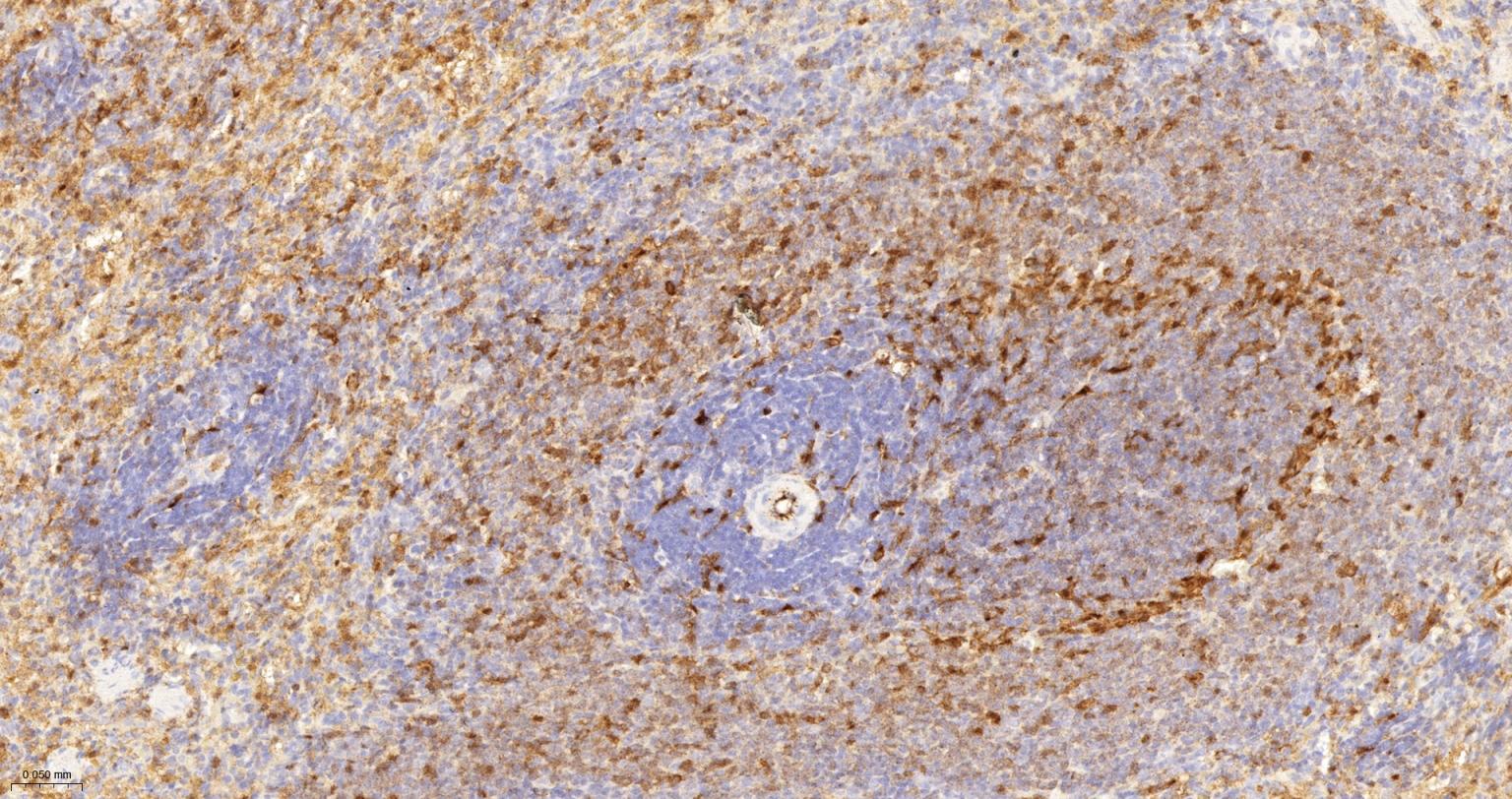 FC段γ受体3/免疫球蛋白G Fc段受体III重组兔单抗