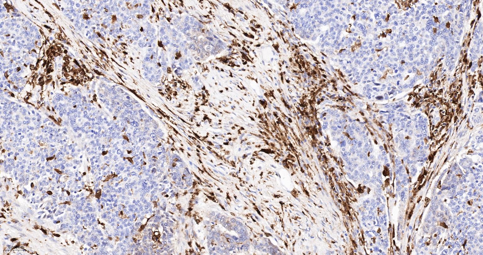 FC段γ受体3/免疫球蛋白G Fc段受体III重组兔单抗