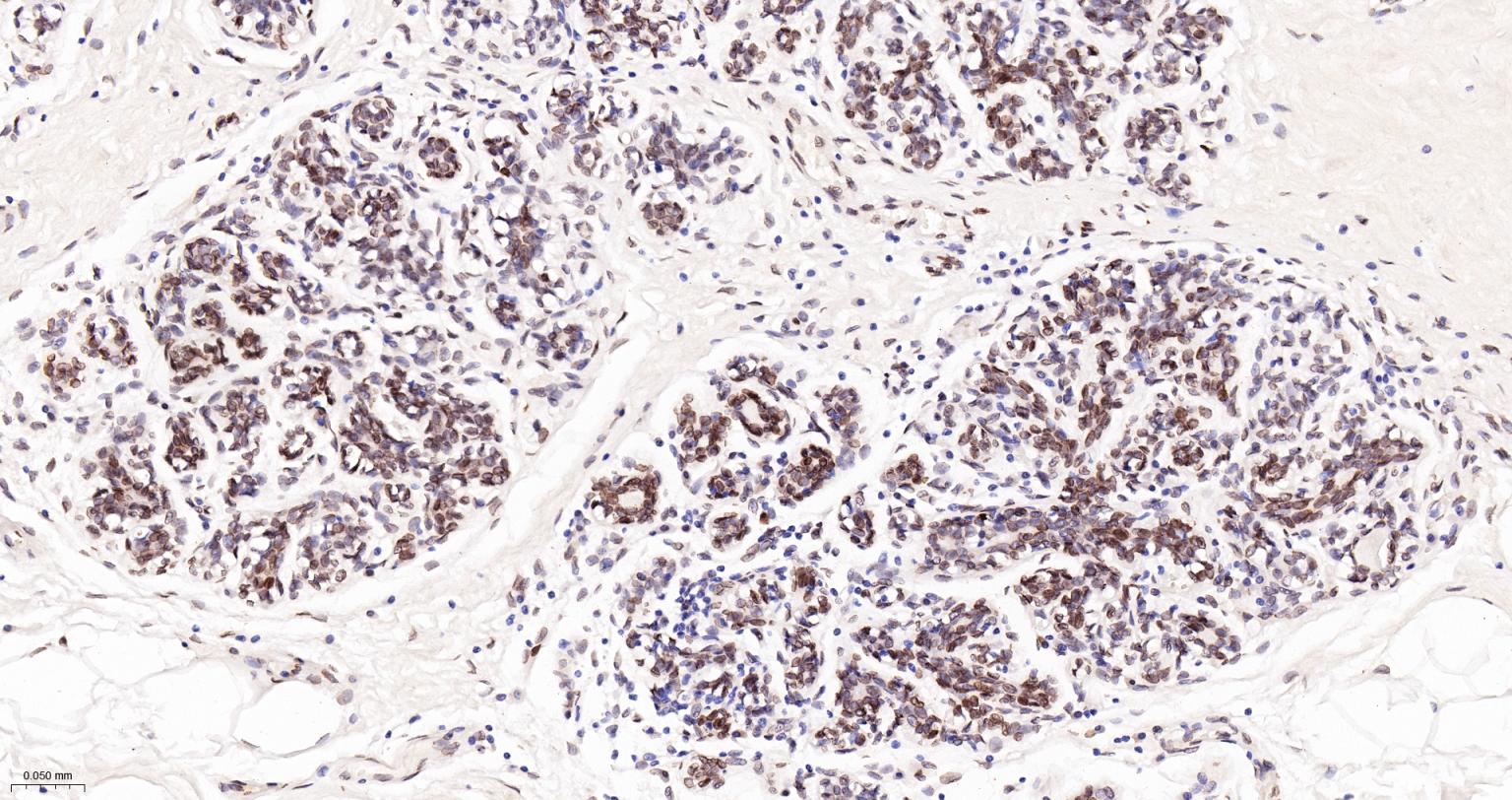 核纤层蛋白A/C单克隆抗体-bsm-51683M