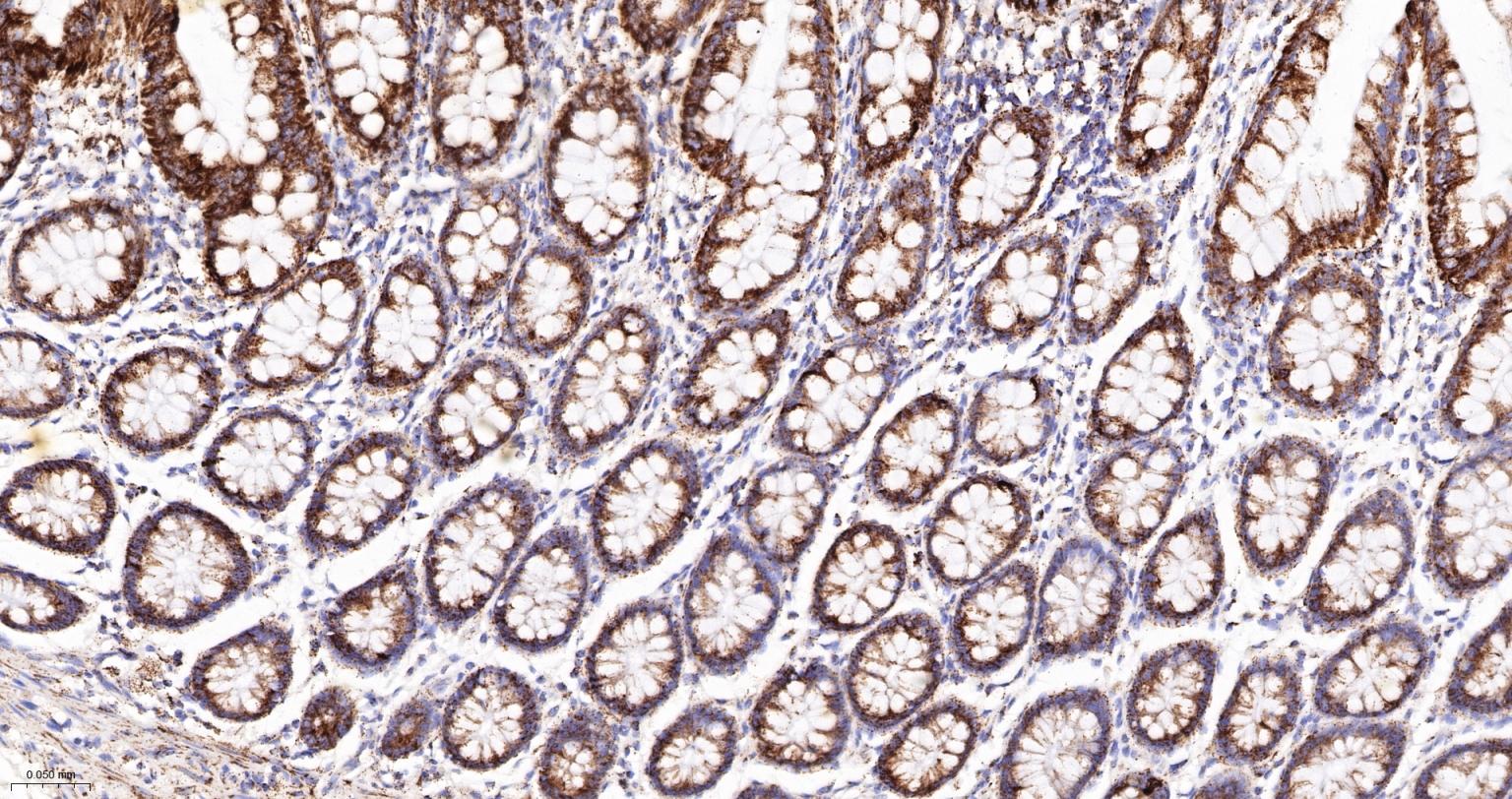 线粒体苹果酸脱氢酶2重组兔单抗