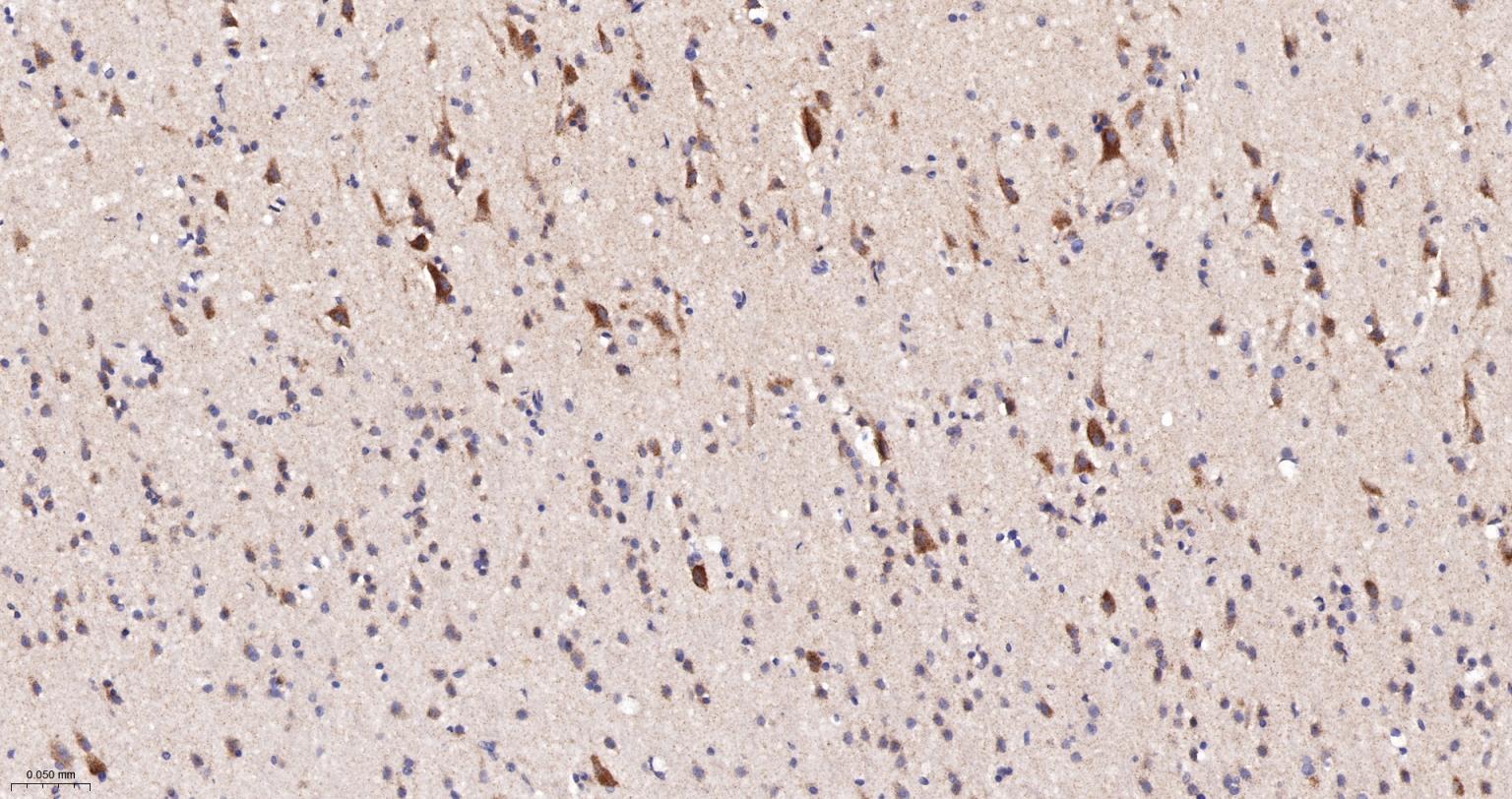 NDUFS2重组兔单抗