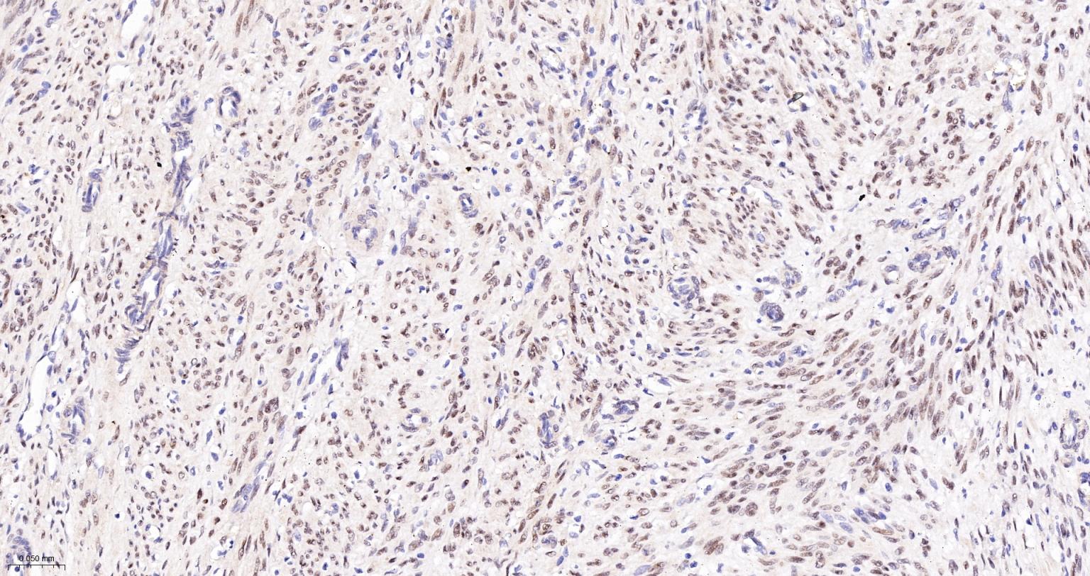 TEAD1重组兔单抗