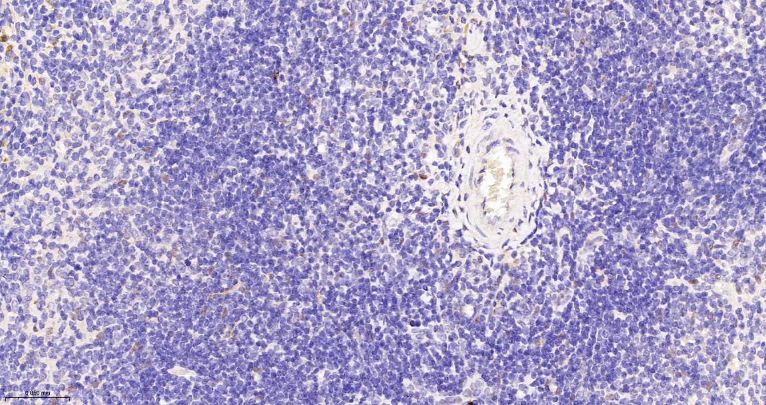 TEAD1重组兔单抗
