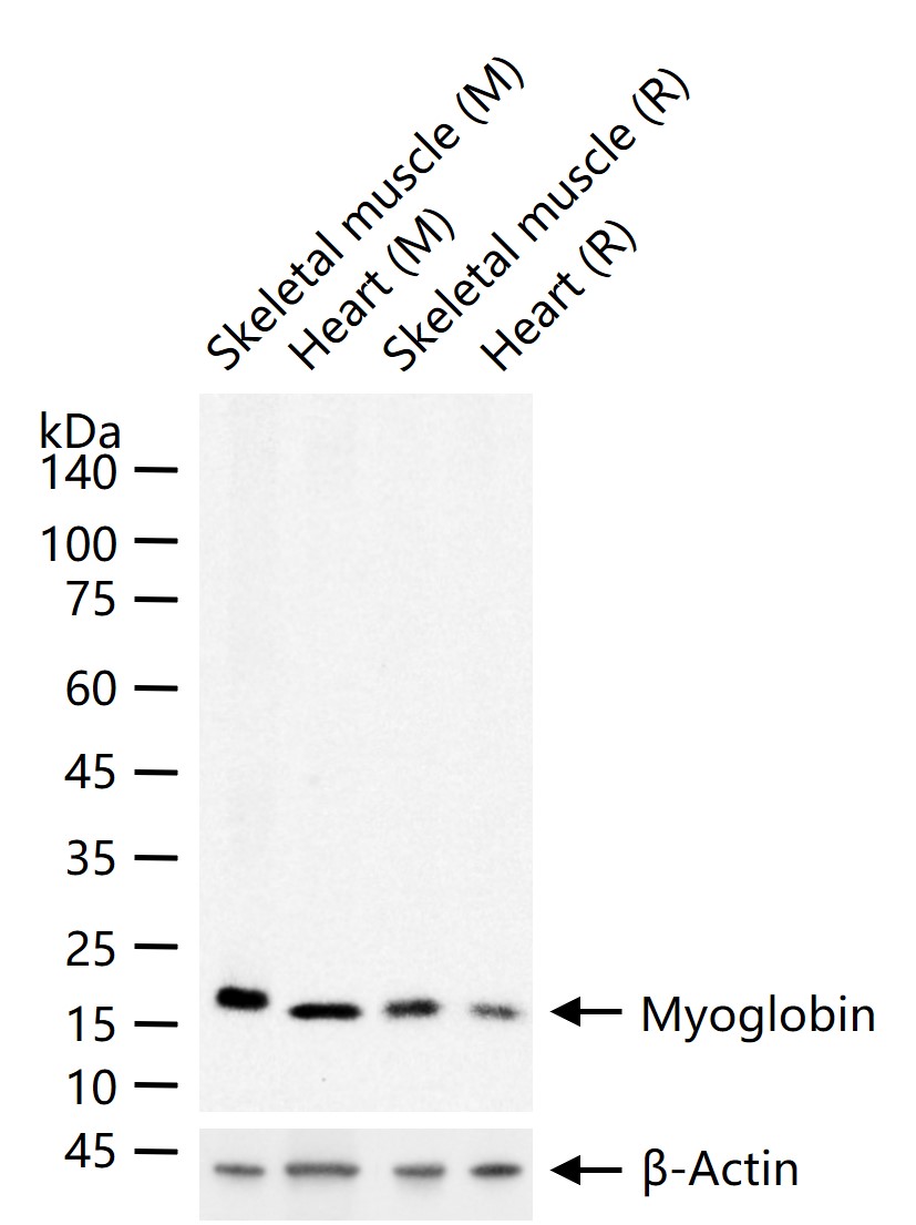 肌红蛋白重组兔单抗