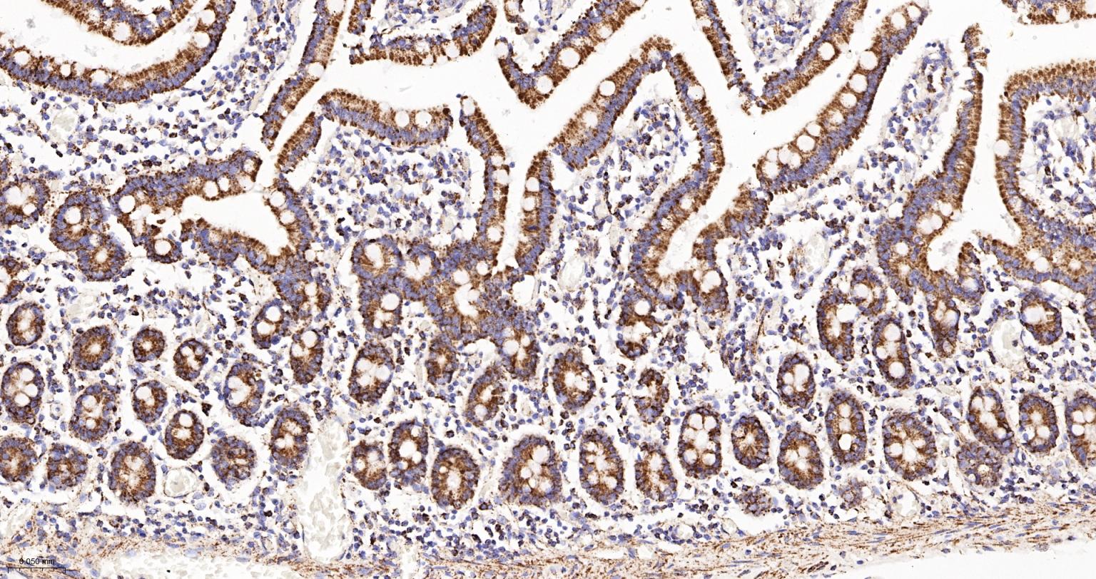 线粒体苹果酸脱氢酶2重组兔单抗