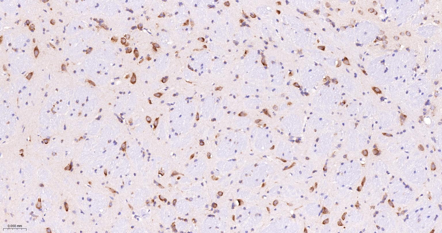 受体激活蛋白激酶C1重组兔单抗