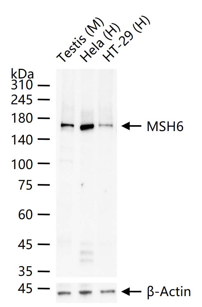 错配修复蛋白6重组兔单抗