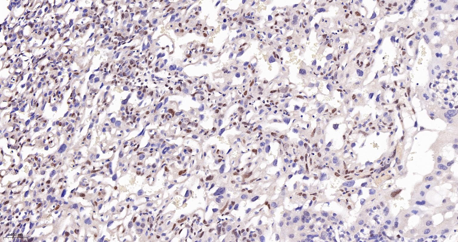 TEAD1重组兔单抗