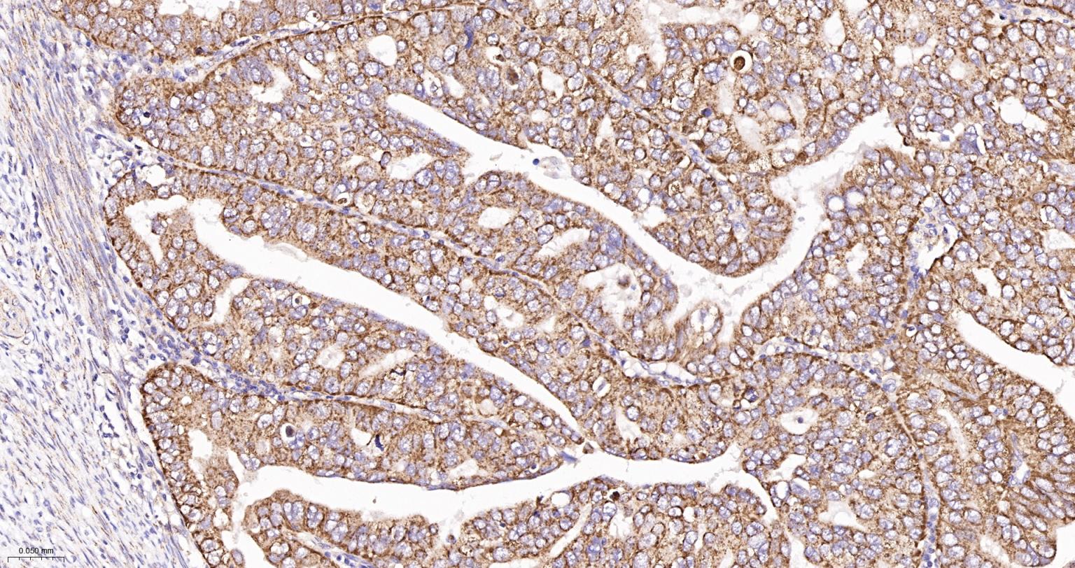 凋亡诱导因子重组兔单抗