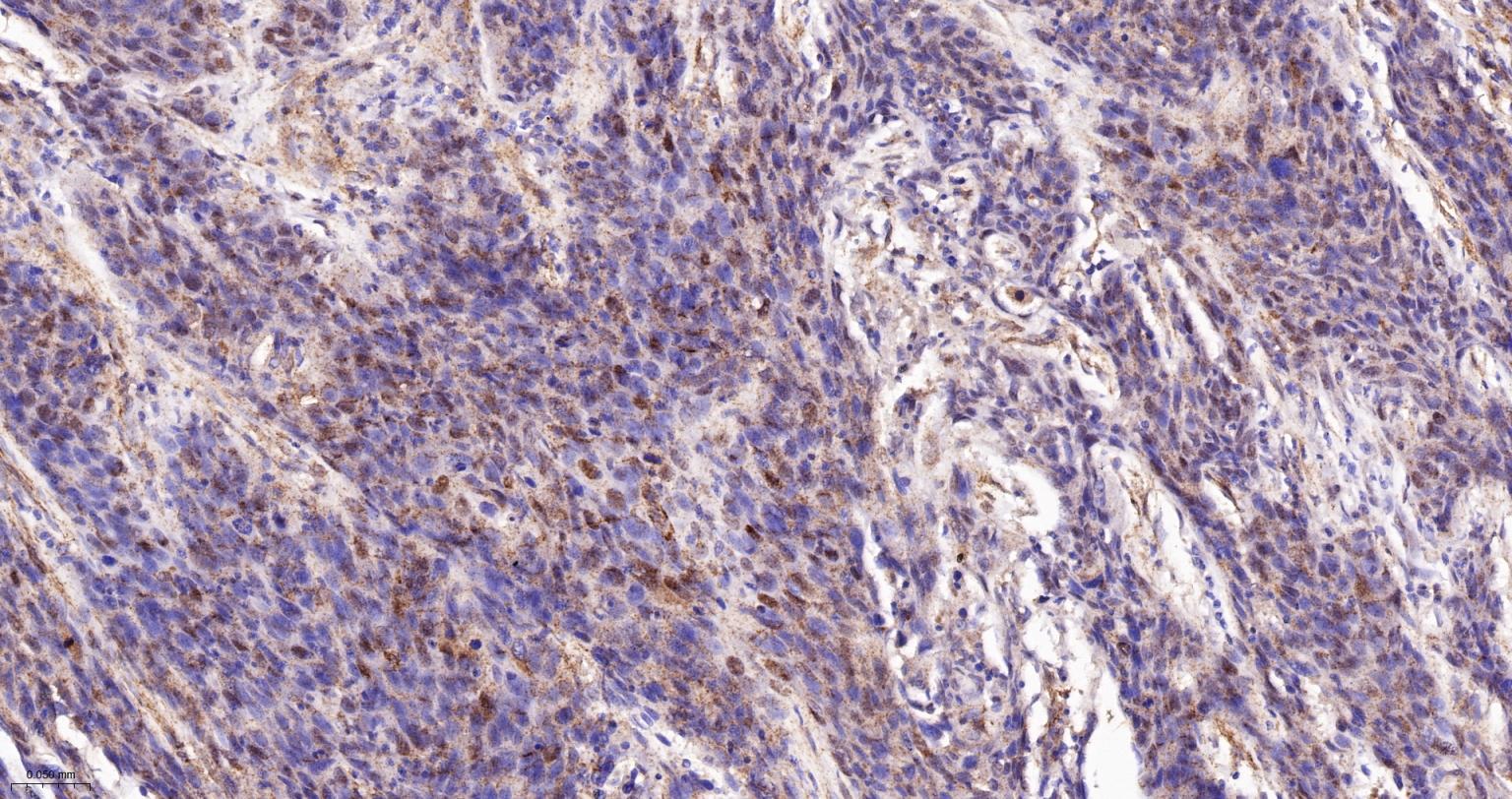 受体激活蛋白激酶C1重组兔单抗