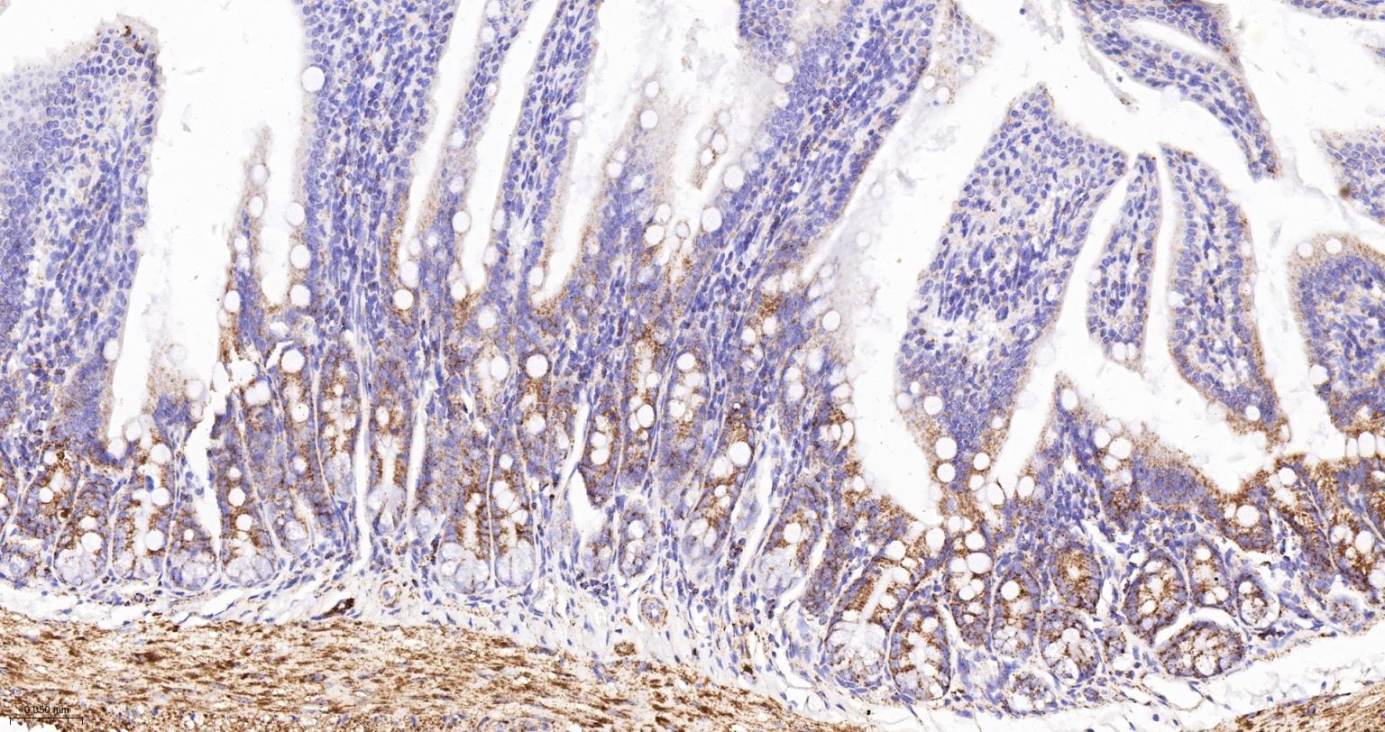 线粒体苹果酸脱氢酶2重组兔单抗
