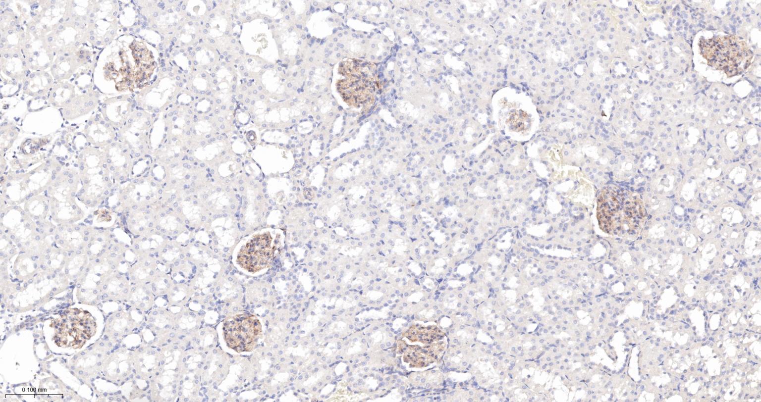 胞质紧密粘连蛋白1/闭锁小带蛋白1重组兔单抗