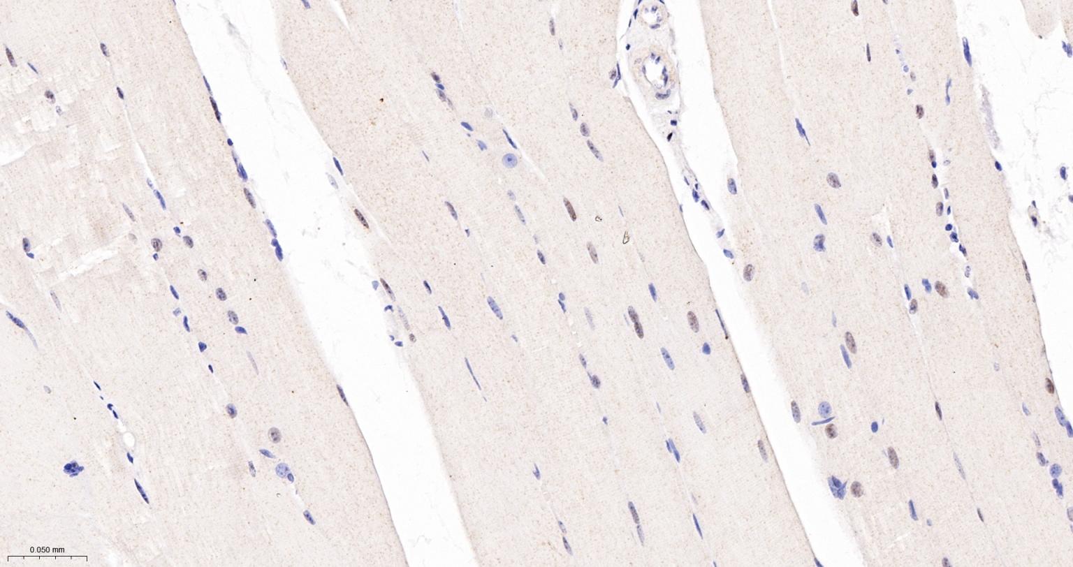TEAD1重组兔单抗
