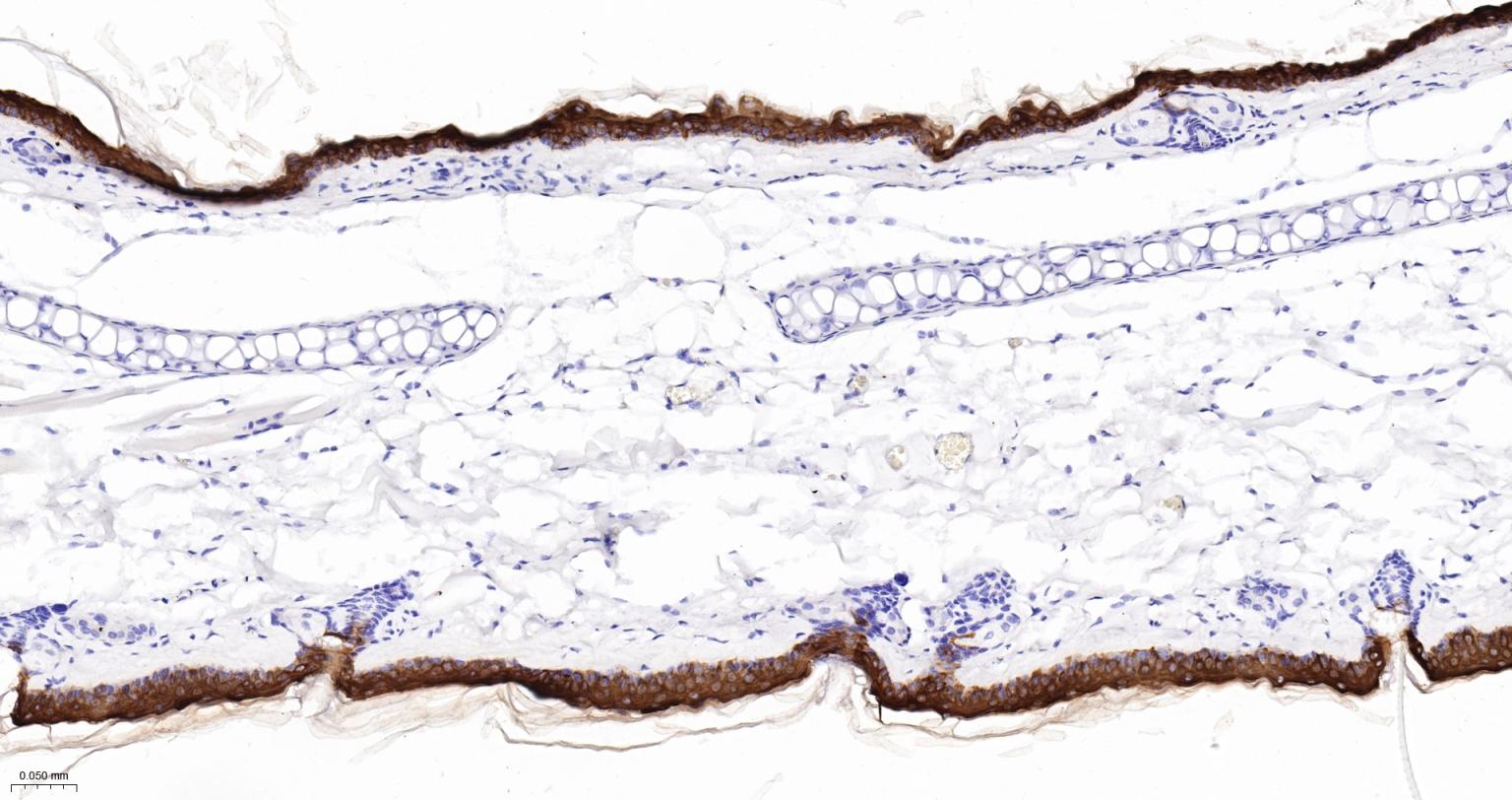 细胞角蛋白10重组兔单抗