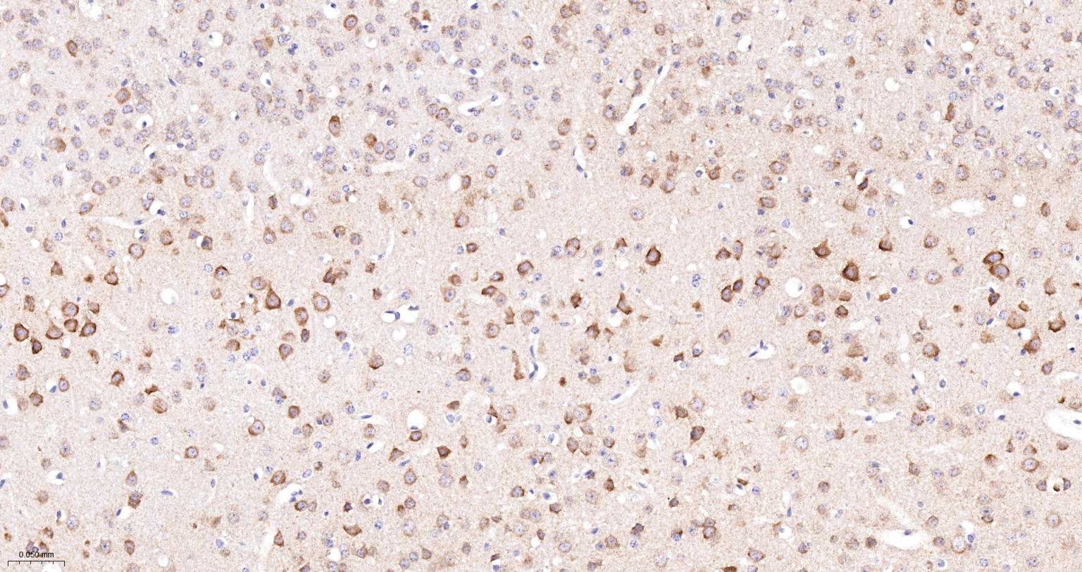 受体激活蛋白激酶C1重组兔单抗