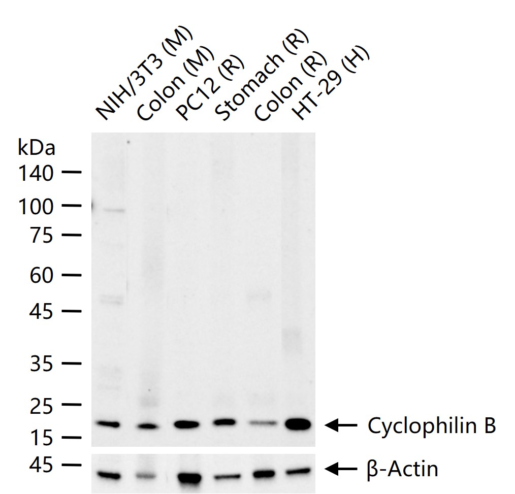 Cyclophilin B Mouse mAb, Loading Control (一抗) - WB,IHC-P,IHC-F,IF | Bioss