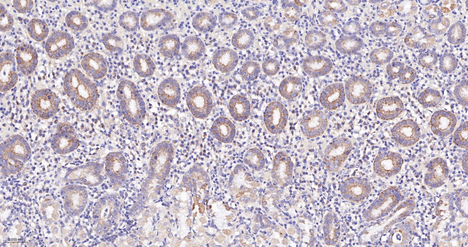 NDUFS2重组兔单抗