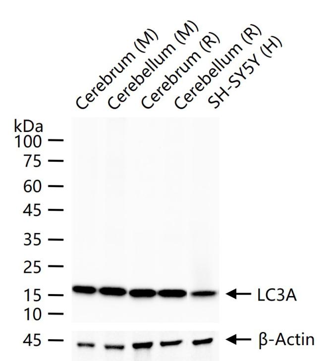 自噬微管相关蛋白轻链3重组兔单抗