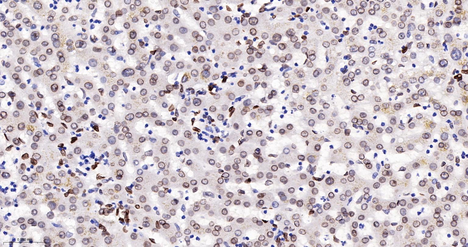 核纤层蛋白A/C单克隆抗体-bsm-51683M