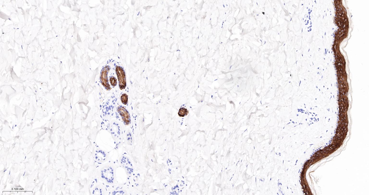 细胞角蛋白10重组兔单抗