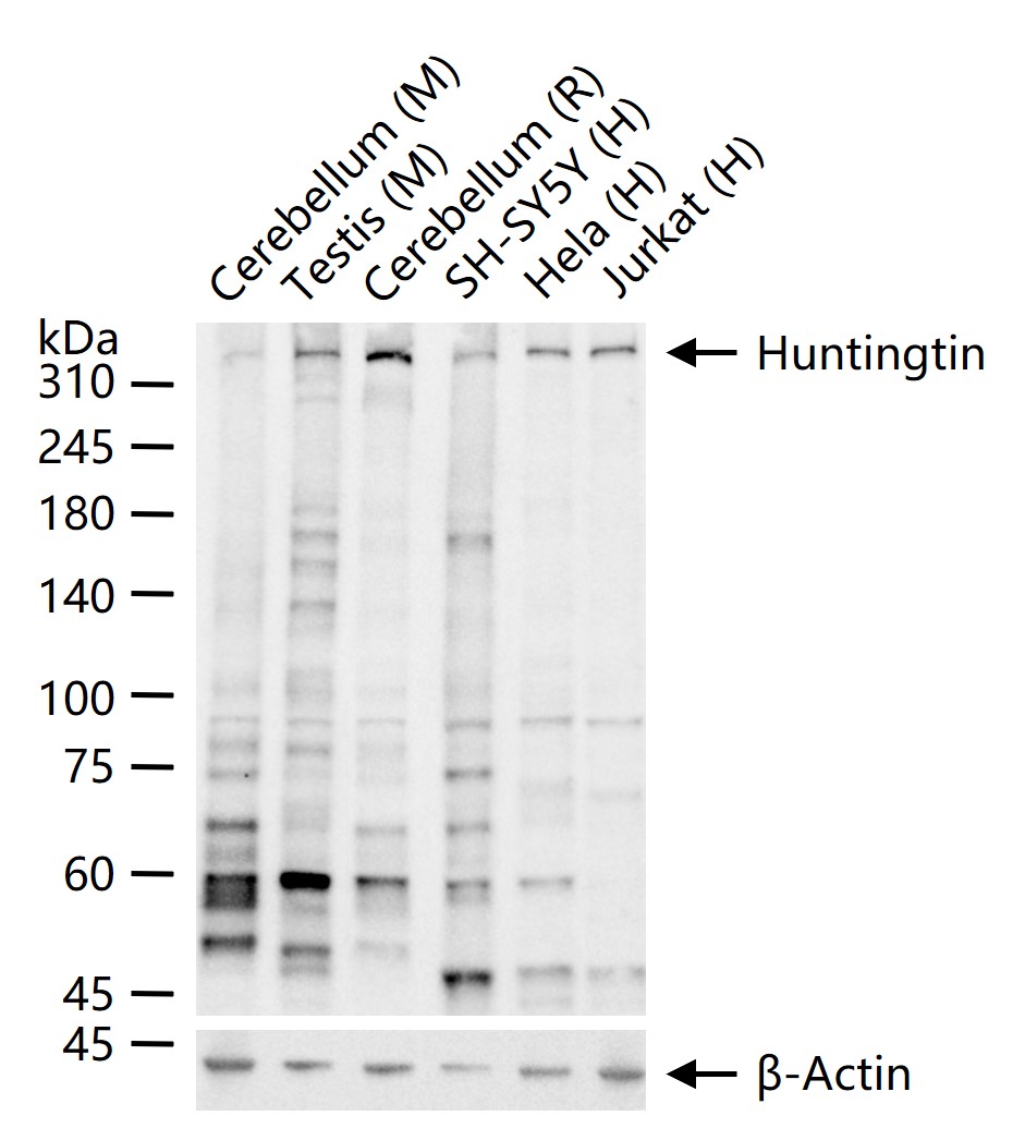 神经性舞蹈病蛋白重组兔单抗