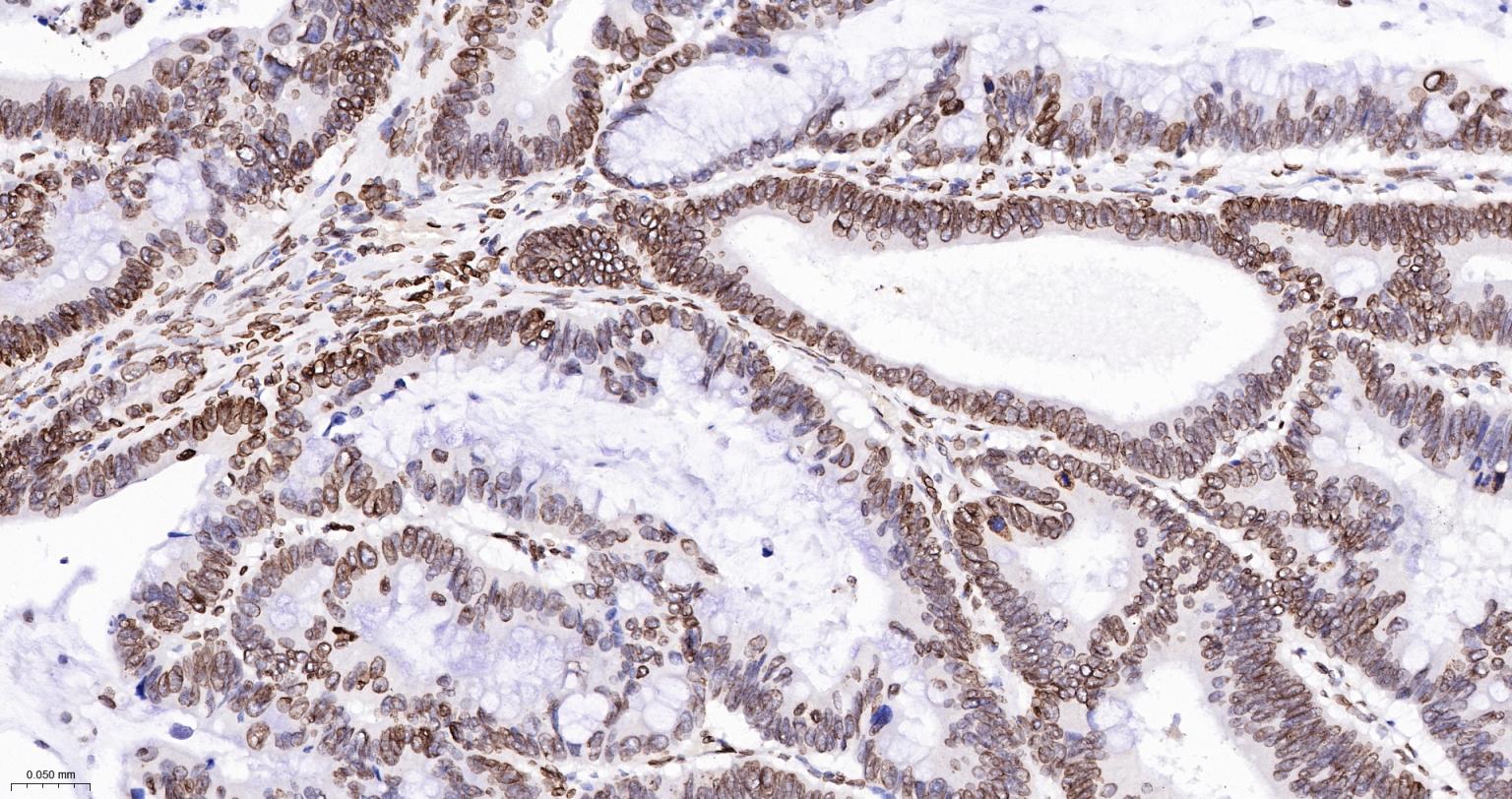 核纤层蛋白A抗体-bsm-34042M