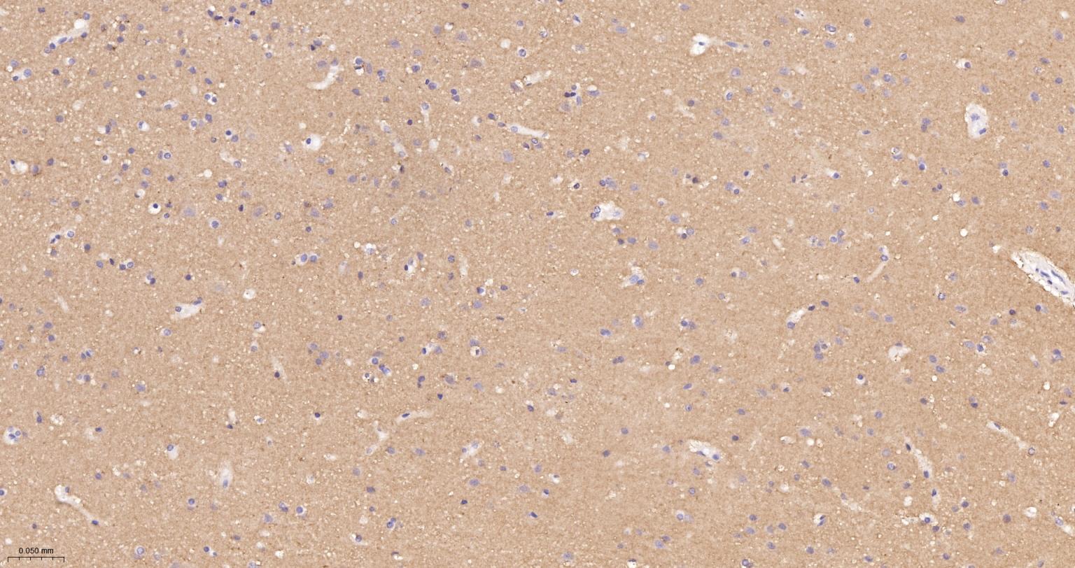 受体激活蛋白激酶C1重组兔单抗