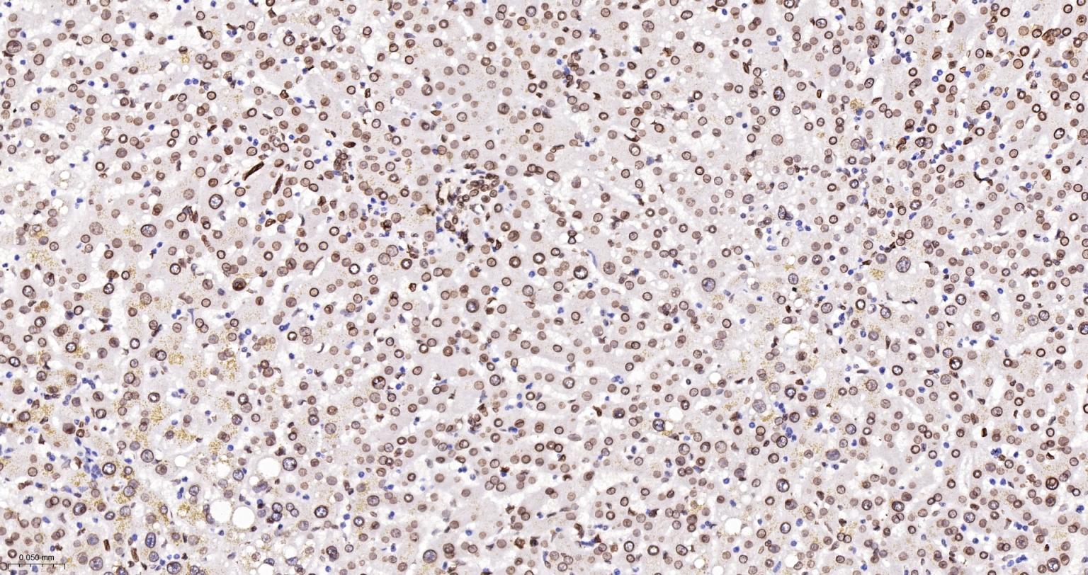 核纤层蛋白A抗体-bsm-34042M