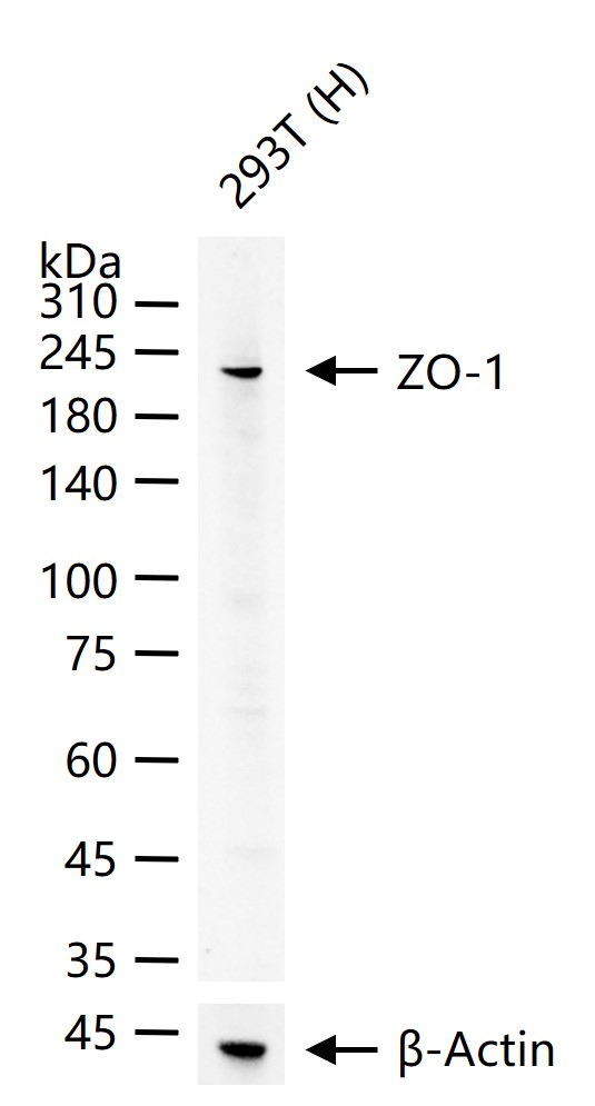 胞质紧密粘连蛋白1/闭锁小带蛋白1重组兔单抗