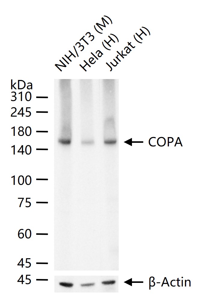 COPA Recombinant Rabbit mAb (一抗) - WB,IHC-P,IHC-F,IF | Bioss
